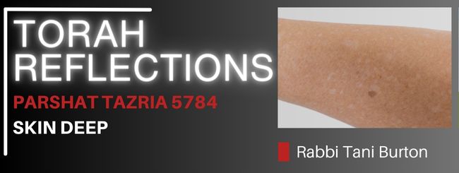 PARSHAT TAZRIA 5784 – SKIN DEEP